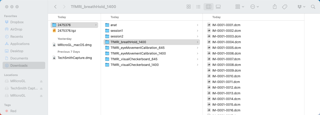 ../_images/02_DataStructure.png