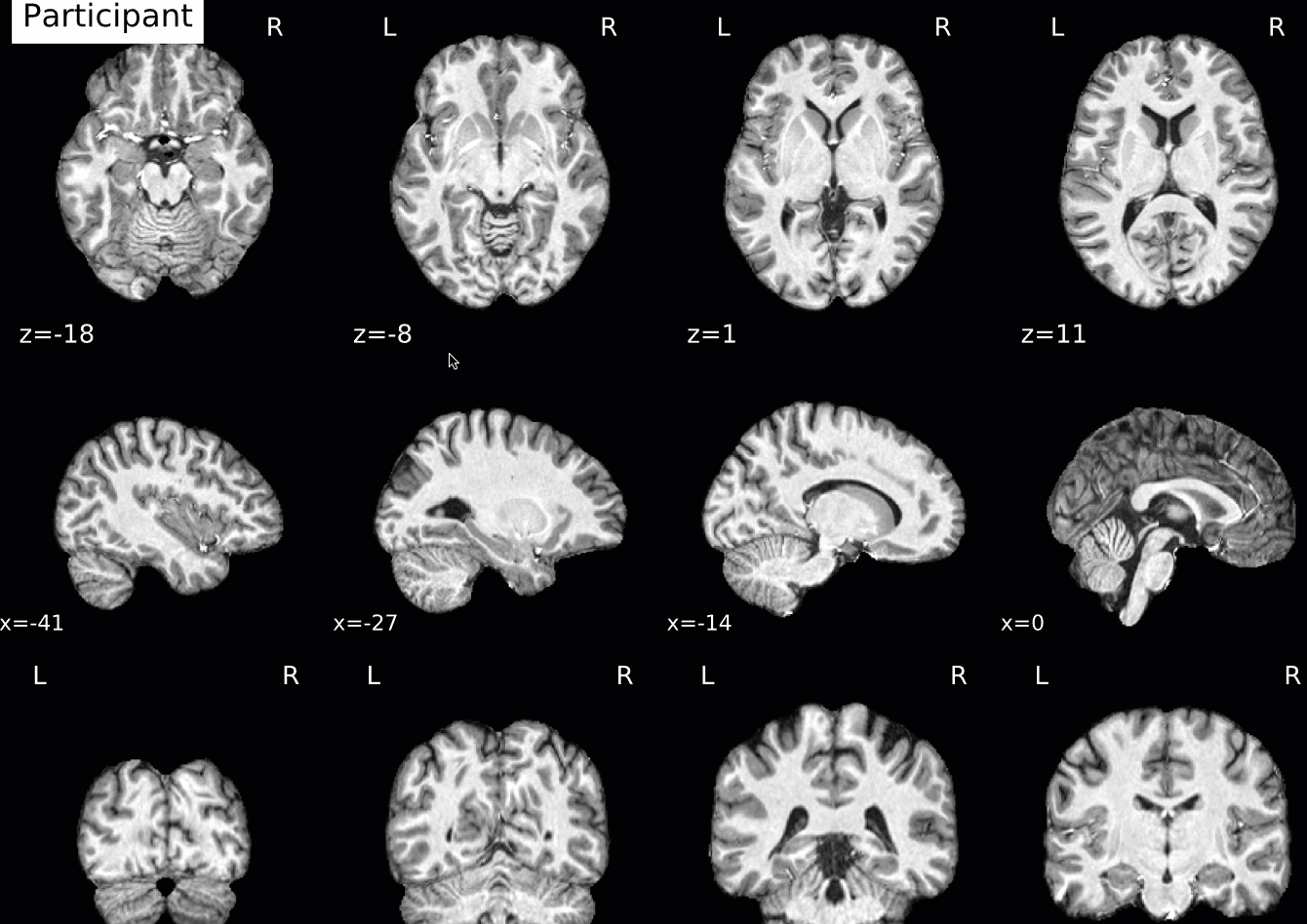 ../../_images/03_AnatomicalQA.gif