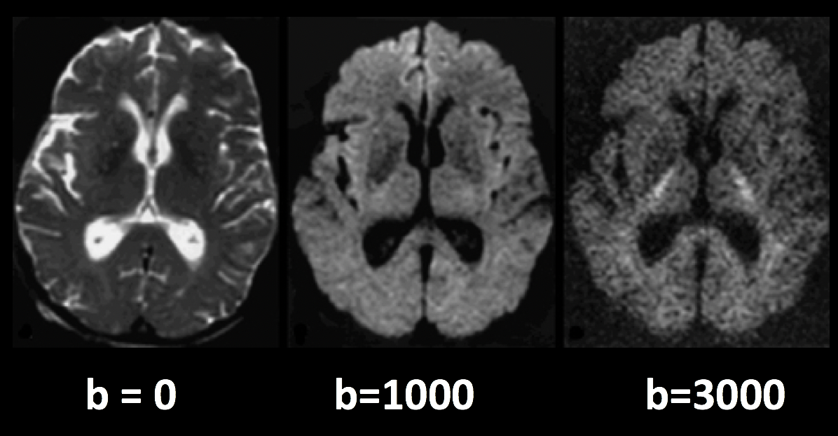../../_images/03_bvals.png