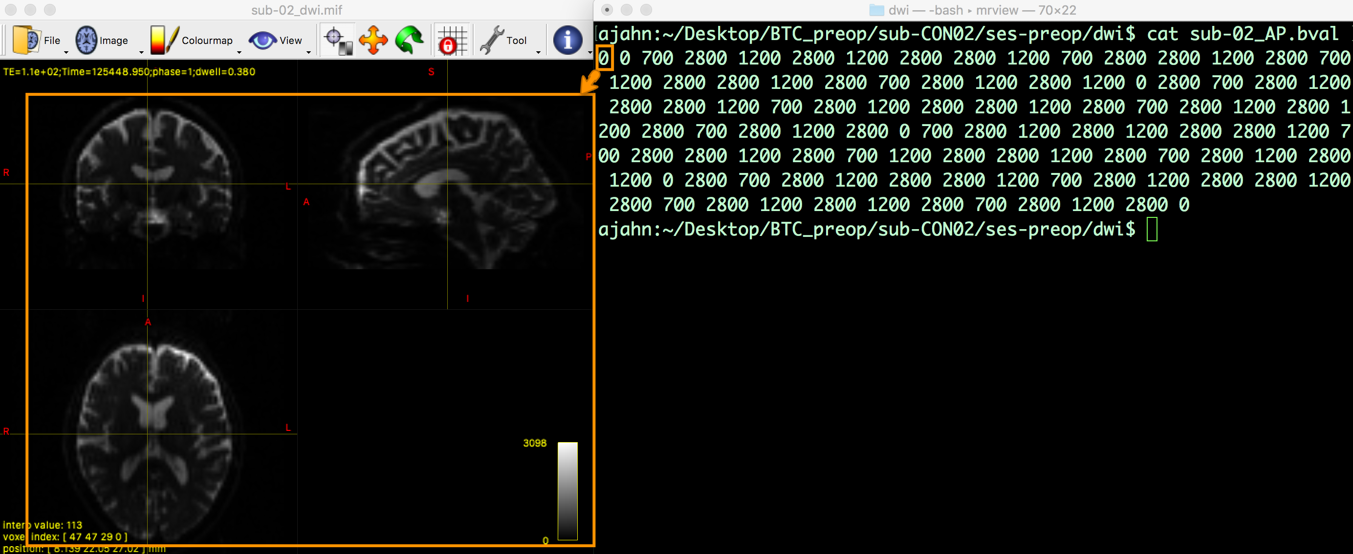 ../../_images/03_mrview_firstVolume_bval.png