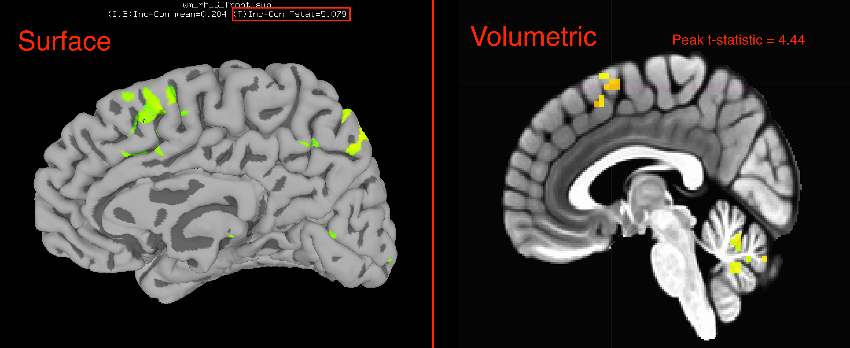 ../../../_images/09_04_Surface_Volumetric_Results.png