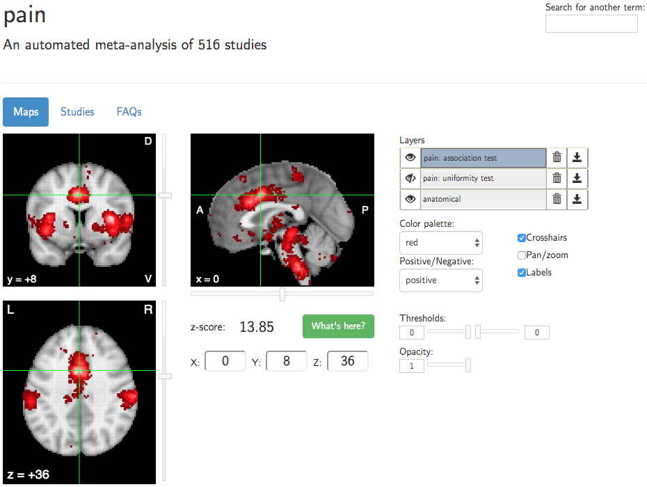 ../../_images/Appendix_E_Pain_Neurosynth.png