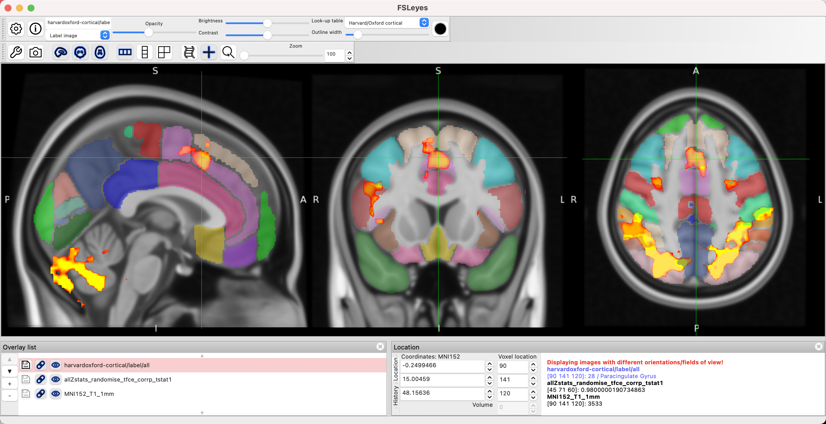 ../_images/fsleyes_example.png
